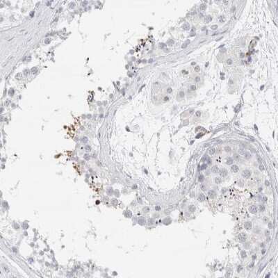 Immunohistochemistry-Paraffin: Septin-4 Antibody [NBP1-90093]