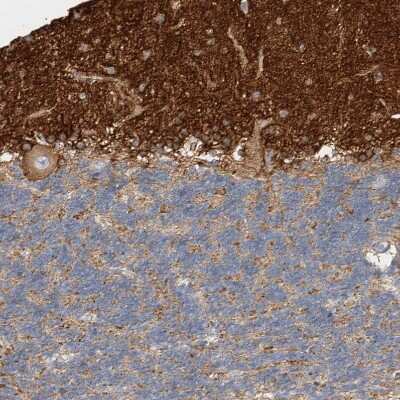Immunohistochemistry-Paraffin: Septin-4 Antibody [NBP1-90093]