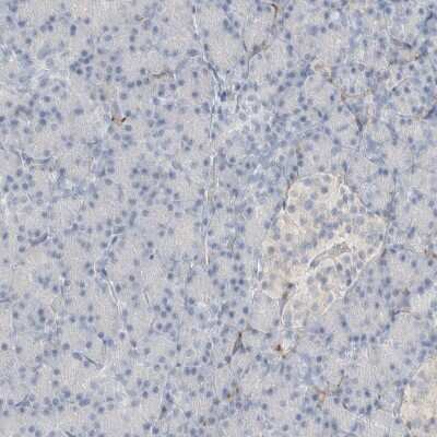 Immunohistochemistry-Paraffin: Septin-4 Antibody [NBP1-90093]