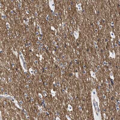 Immunohistochemistry-Paraffin: Septin-4 Antibody [NBP1-90094]
