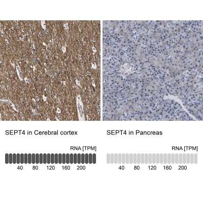 Immunohistochemistry-Paraffin: Septin-4 Antibody [NBP1-90094]