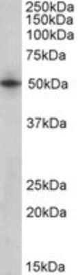 Western Blot: Septin-4 Antibody [NBP1-52095]