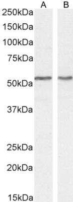 Western Blot: Septin-4 Antibody [NBP1-52096]