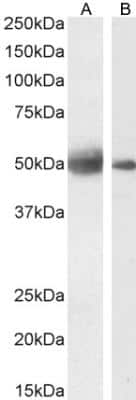 Western Blot: Septin-4 Antibody [NBP1-52096]