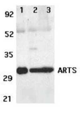 Western Blot: Septin-4 AntibodyBSA Free [NBP1-76667]