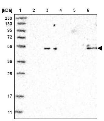 Western Blot: Septin-4 Antibody [NBP1-90094]