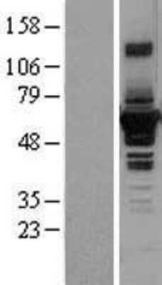 Western Blot: Septin-4 Overexpression Lysate [NBL1-07142]