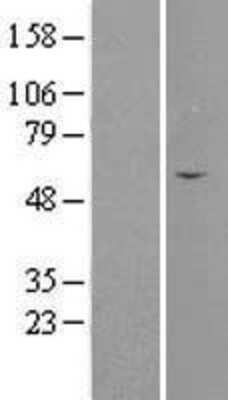 Western Blot: Septin-4 Overexpression Lysate [NBL1-07144]