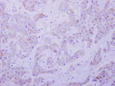 Immunohistochemistry-Paraffin: Septin-5 Antibody [NBP2-15115]