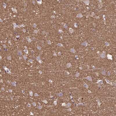 Immunohistochemistry-Paraffin: Septin-5 Antibody [NBP2-48588]