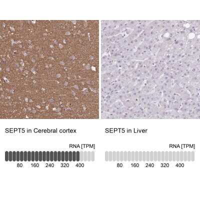 Immunohistochemistry-Paraffin: Septin-5 Antibody [NBP2-48588]
