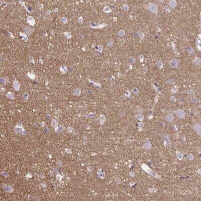 Immunohistochemistry-Paraffin: Septin-5 Antibody [NBP2-49407]
