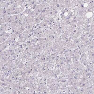 Immunohistochemistry-Paraffin: Septin-5 Antibody [NBP2-49407]