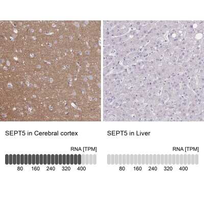Immunohistochemistry-Paraffin: Septin-5 Antibody [NBP2-49407]