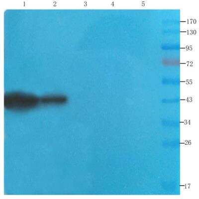 Western Blot: Septin-5 Antibody (SP18)ChimericAzide and BSA Free [NBP2-81056]