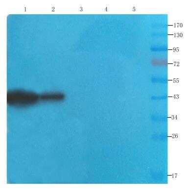 Western Blot: Septin-5 Antibody (SP18)Azide and BSA Free [NBP2-81058]