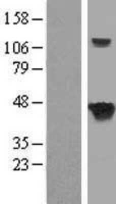 Western Blot: Septin-5 Overexpression Lysate [NBL1-07145]