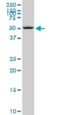 Western Blot: Septin-6 Antibody (1D6) [H00023157-M01]