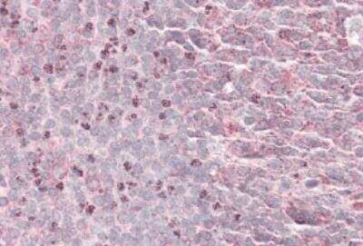 Immunohistochemistry-Paraffin: Septin-6 Antibody [NBP1-51930]