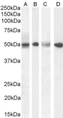 Western Blot: Septin-6 Antibody [NBP1-51930]