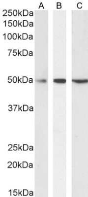 Western Blot: Septin-6 Antibody [NBP1-51930]