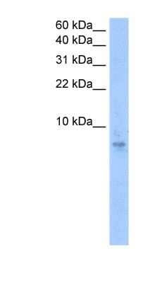 Western Blot: Septin-6 Antibody [NBP1-52840]