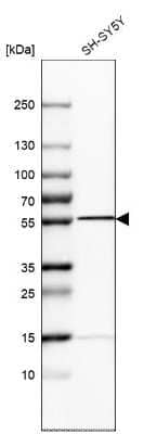 Western Blot: Septin-6 Antibody [NBP1-89626]