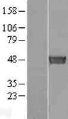 Western Blot: Septin-6 Overexpression Lysate [NBL1-07147]