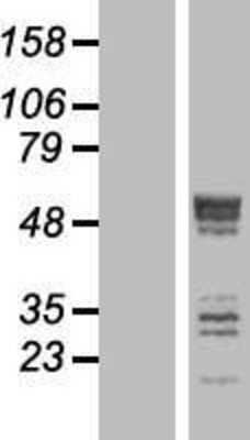 Western Blot: Septin-6 Overexpression Lysate [NBP2-05473]