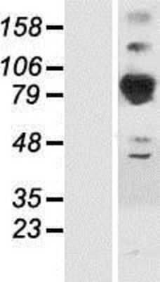 Western Blot: Septin-6 Overexpression Lysate [NBP2-05474]