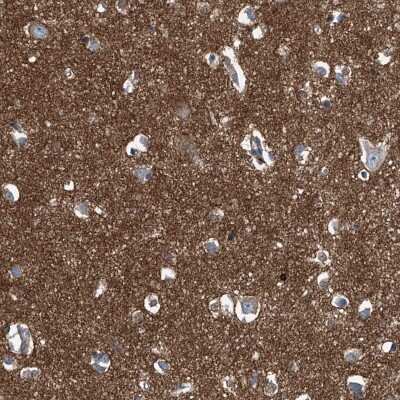 Immunohistochemistry-Paraffin: Septin-7 Antibody [NBP1-85730]