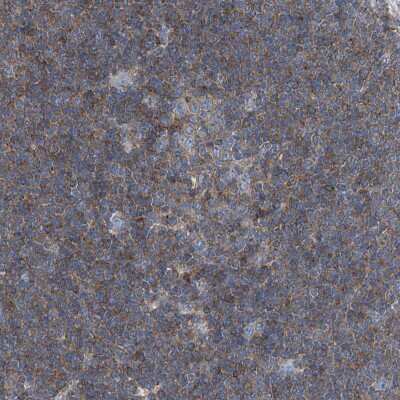 Immunohistochemistry-Paraffin: Septin-7 Antibody [NBP1-85730]