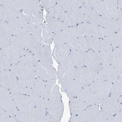 Immunohistochemistry-Paraffin: Septin-7 Antibody [NBP1-85730]