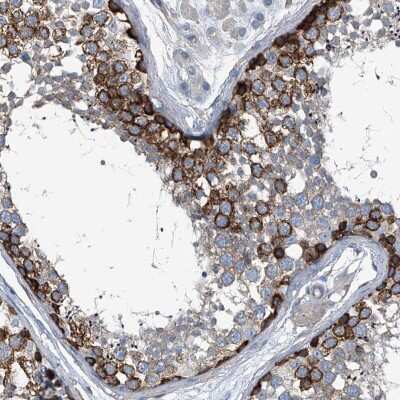 Immunohistochemistry-Paraffin: Septin-7 Antibody [NBP1-85730]