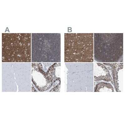 Immunohistochemistry-Paraffin: Septin-7 Antibody [NBP1-85730]
