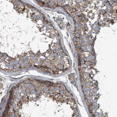 Immunohistochemistry-Paraffin: Septin-7 Antibody [NBP1-85731]