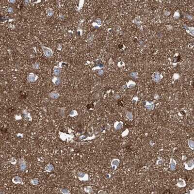 Immunohistochemistry-Paraffin: Septin-7 Antibody [NBP1-85731]