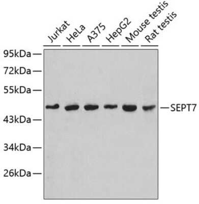 Immunohistochemistry-Paraffin: Septin-7 Antibody - BSA Free [NBP3-03670]