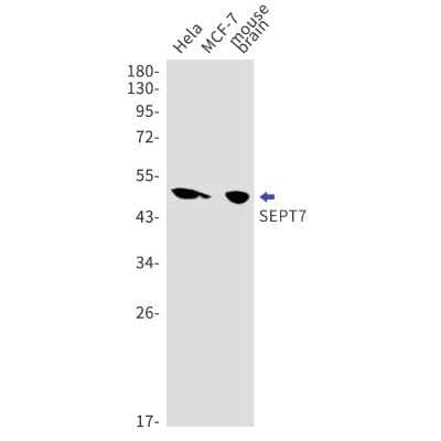 Western Blot: Septin-7 Antibody (S09-6A1) [NBP3-15090]