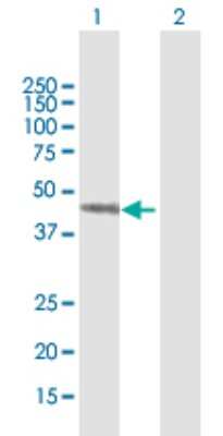 Western Blot: Septin-7 Antibody [H00000989-B01P]