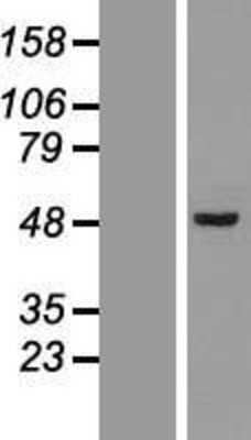 Western Blot: Septin-7 Overexpression Lysate [NBL1-07149]