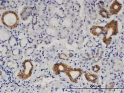 Immunohistochemistry-Paraffin: Septin-8 Antibody (3G1) [H00023176-M08]