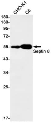 Western Blot: Septin-8 Antibody (S05-2C6) [NBP3-19916]