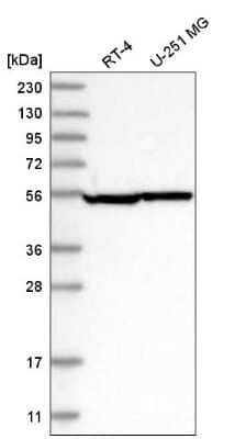 Western Blot: Septin-8 Antibody [NBP2-76533]