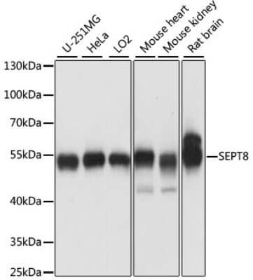 Western Blot: Septin-8 AntibodyAzide and BSA Free [NBP2-93880]