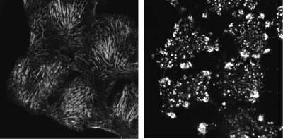 Immunocytochemistry/ Immunofluorescence: Septin-9 Antibody [NBP1-28711]