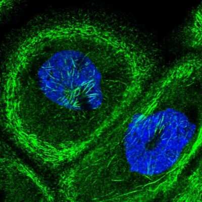 Immunocytochemistry/ Immunofluorescence: Septin-9 Antibody [NBP2-13294]