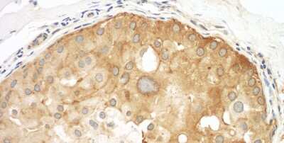 Immunohistochemistry-Paraffin: Septin-9 Antibody [NBP1-28764]