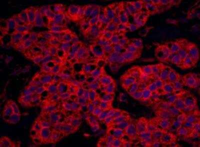Immunohistochemistry-Paraffin: Septin-9 Antibody [NBP1-28711]