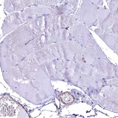 Immunohistochemistry-Paraffin: Septin-9 Antibody [NBP2-13294]